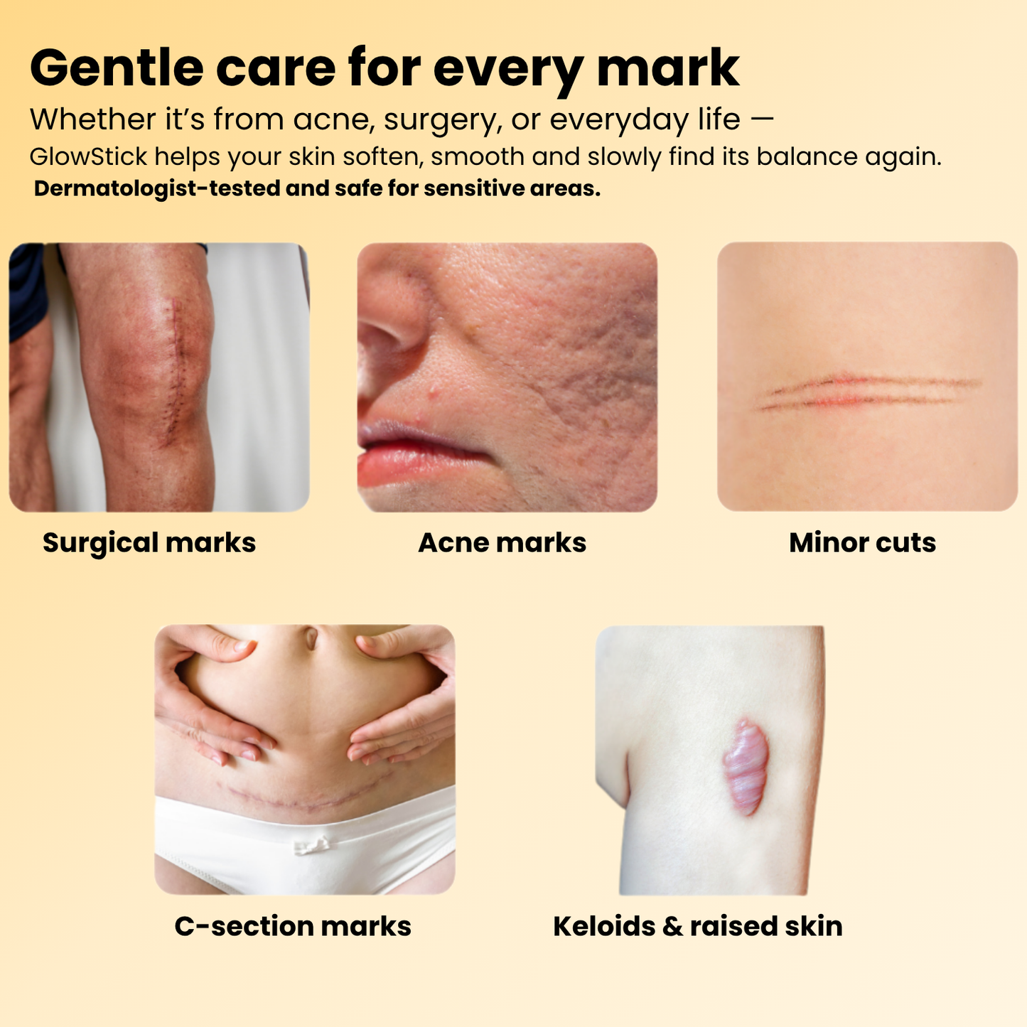 Lumalie® Derma Stick