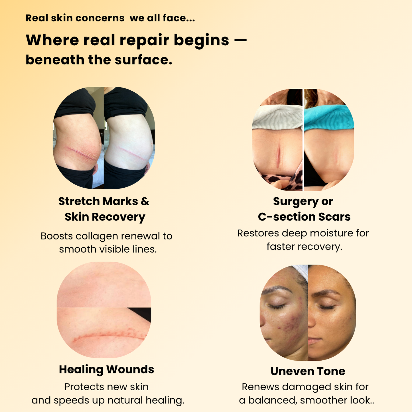 Lumalie® Derma Stick