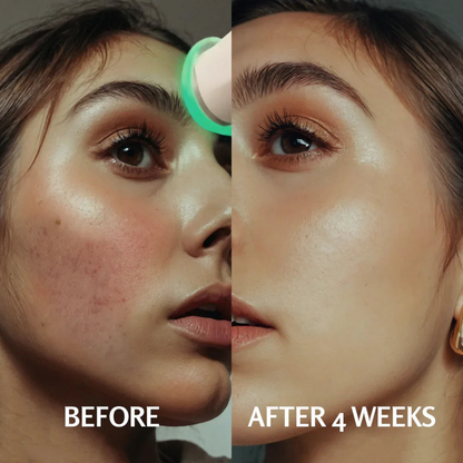 Lumalie® HydraGlow O₂